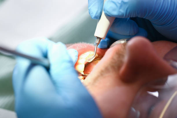 Best Emergency Tooth Extraction  in Peoria, IL